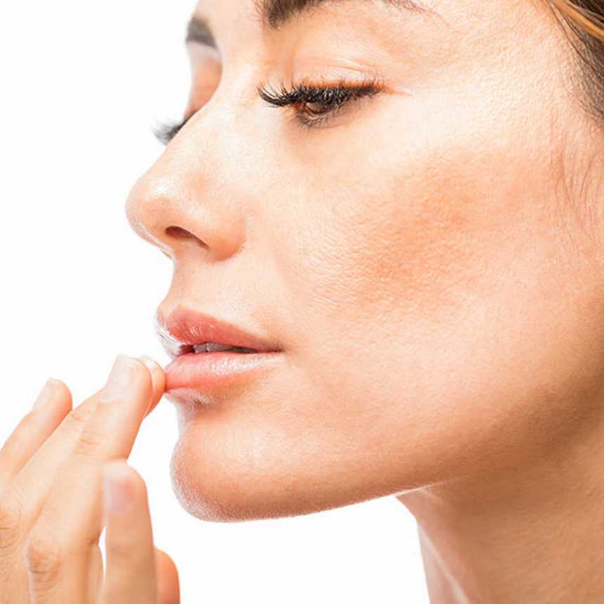  Can You Get Rid of Chapped Lips?