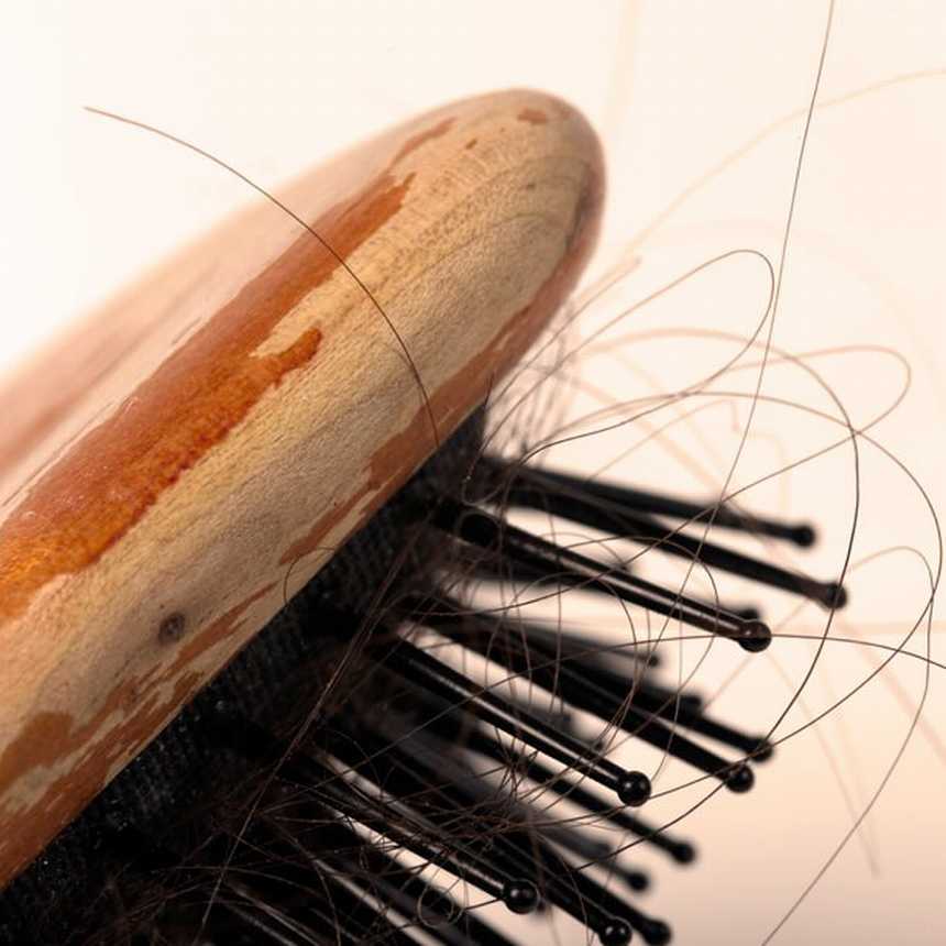  Hair Loss: Causes, Therapies, and Prevention