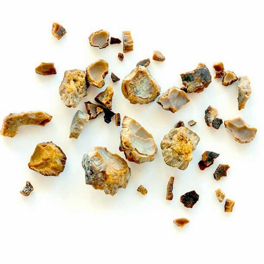  Kidney Stones: Signs, Causes, and Therapy